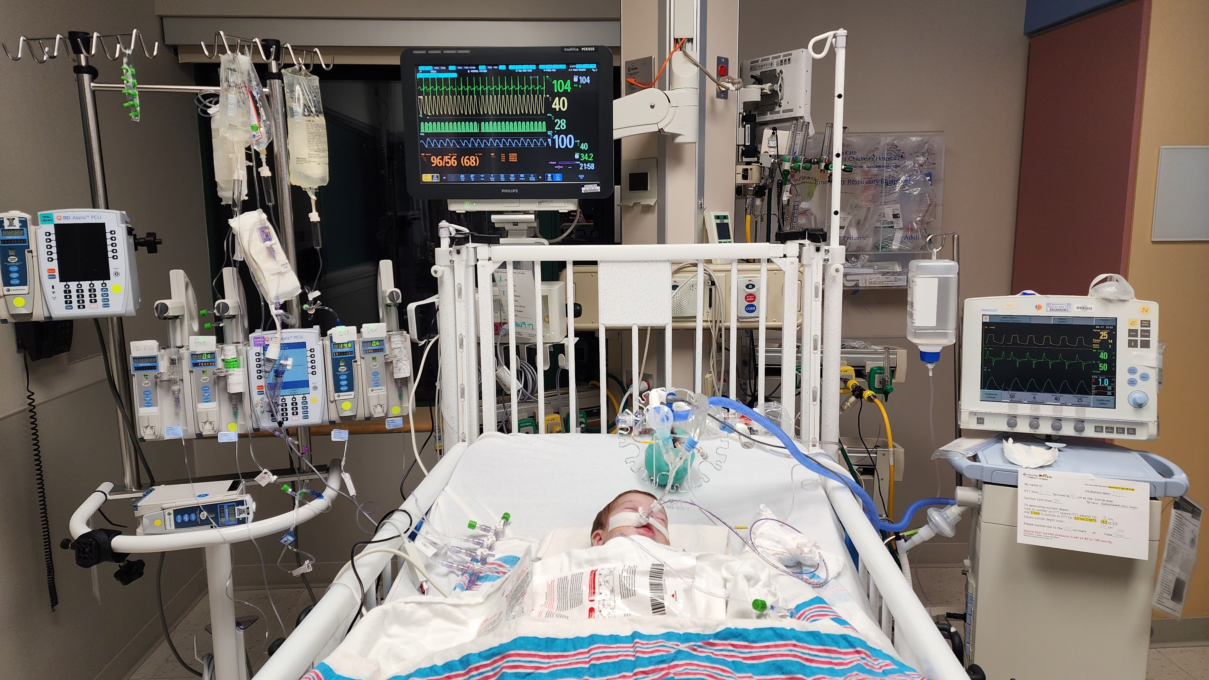 Father at bedside of newborn daughter with Cystic Fibrosis — Metra Chicago commuter rail fired him while she was hospitalized